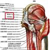 梨状筋症候群