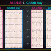 ECG-351：answer