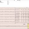 ECG-206：90才代男性。動悸と息切れで搬入されました。