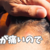 粉瘤。