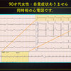 ECG-359：answer:その1　まず 等頻度房室解離= 心電図検定試験：傾向と対策 Q.007 =