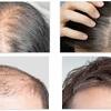 Revifol : Strengthen Root Level And Get Stronge Hair