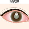 【緑内障】定期検診に行ってきた。