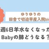 23週6日　羊水がなくなったらBabyの肺はどうなる？