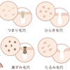 毛穴よ、年齢を語るな。〜おばさん毛穴ケア、気にしすぎる前に読む話〜