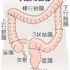 増える大腸がん死