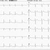 ECG-104：25才男性。突然の胸痛でER受診です。