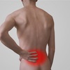 【解説】腰部脊柱管狭窄症の原因や運動について解説