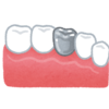 歯の詰め物が取れたので、歯医者に言ったら67万掛かると言われてしまった