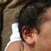 乳児性湿疹？ 赤ちゃんの顔にブツブツがいっぱい！