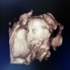 妊婦健診記録　22週　胎児スクリーニングの結果