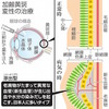 加齢黄斑変性