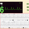 ECG-196：60才代女性。状態悪化した際の心電図モニターです。