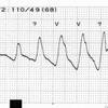 ECG-127：126の症例が、意識障害を呈しました！