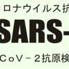 2020/05/21のメモ　保険適用の抗原検査は無症状者への使用には適さない　新型コロナ