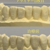 治療経過【2カ月半】