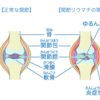 やっと巡りあった回復施術