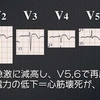 ECG-153：answer