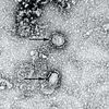 厚生労働省が発表した新型コロナウイルスによる、感染症の蔓延防止策
