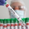 米政府、mRNA鳥インフルエンザワクチン試験に資金提供
