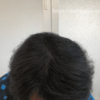 男性の薄毛対策におすすめ！CAX（カックス）というヘアカバー増毛スプレー！