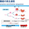 健康の結論　堀江貴文　大腸がん