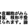 ・病名、病状未告知での肺がん治療は許されるのか