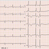 ECG-151：answer