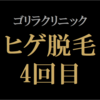 【ヒゲ脱毛4回目】ゴリラクリニック　2022年3月施術　ジェントルヤグ（ヤグレーザー）