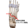 足根中足関節のざっくりとした解剖