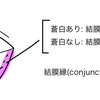 貧血の病歴と身体所見　～眼球結膜蒼白をはじめ～