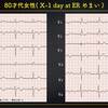 ECG-289：answer