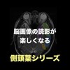 脳画像の読影がとても楽しくなる！側頭葉の各局在を同定する方法