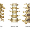 ANTERIOR CERVICAL DISCECTOMY ICD 9 CODE