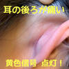 耳の後ろが痛い 黄色信号点灯中