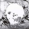  Radiohead / A Moon Shaped Pool