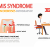 梨状筋症候群（Piriformis syndrome）患者の痛嘆…。