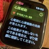 心房細動を治療すべくカテーテルアブレーション手術を受けました