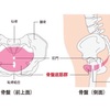 骨盤を整えるヨガ④ 締める力