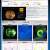 太陽フレアの最新データを定点観測しよう