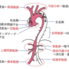 大動脈解離の診察のポイントと緊急度