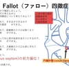 ファロー四徴症( TOF: tetralogy of Fallot )について　臨床経過1　~ 疾患7