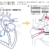 総肺静脈還流異常(TAPVC, TAPVR)について　疾患33