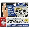 【手湿疹】10年くらい格闘してわかったポイント10個 - 救世主は料理中にも塗れるプロ業務用ハンドクリーム
