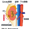 腎臓摘出手術