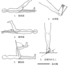 理学療法士　国家試験55a-3