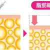 脂肪溶解注射の種類の違いについて