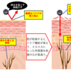 乾燥による痒み　アレルギーとはやとちりするなかれ