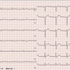 ECG-189:answer