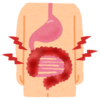 潰瘍性大腸炎が甘いものを食べ続けると治らないわけ　糖質と炎症